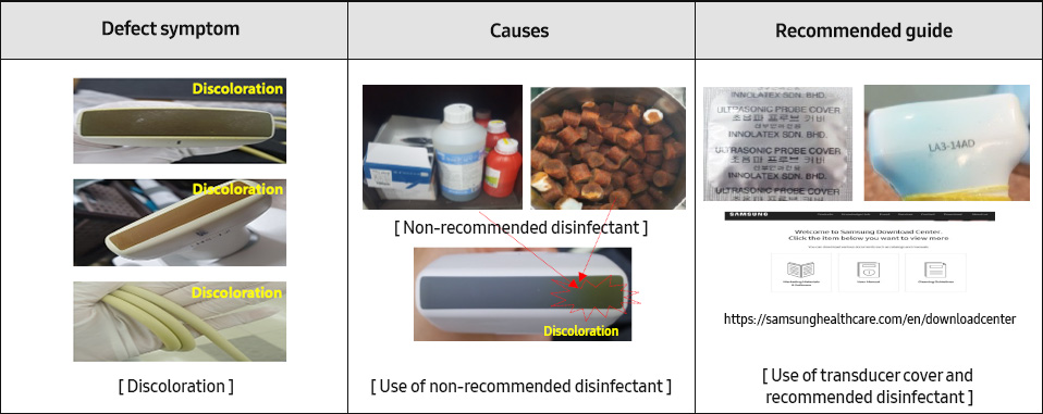 Defect symptom [Lens delamination], Causes - [Non-recommended disinfectant, [Use of rough towel], [Inappropriate use of disinfection equipment], [Long-term use of cover] - [Inappropriate disinfection/use environment] / Recommended guide - [Recommended disinfectant], [Use of soft tissue], [Install according to the recommended method], [Cover should be replaced every time after use] - [Use of recommended disinfectant and soft tissue]