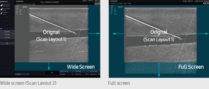 FullScreen layout 1, FullScreen layout2