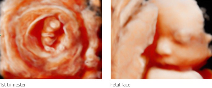 1st trimester, Fetal face