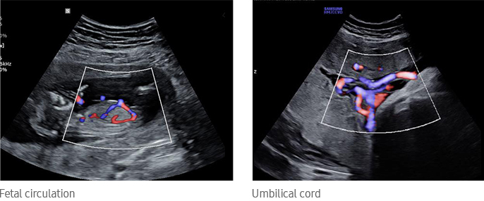 Fetal circulation, Umbilical cord