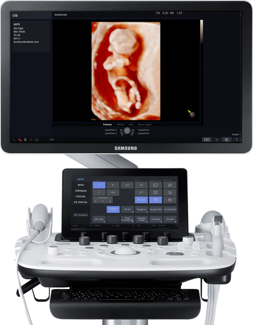 Image result for Samsung's new ultrasound system to spot high-risk pregnancies
