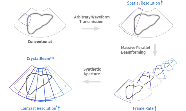 Conventional → Arbitrary Waveform Transmission(Spatial Resolution) → Massive Parallel Beamforming(Frame Rate)  → Synthetic Aperture → CrystalBeam™(Contrast Resolution)