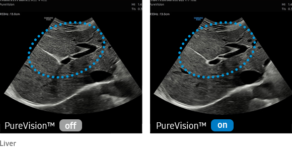 imaging healthcare PureVision™
