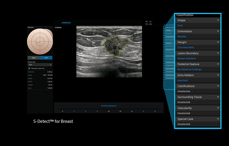 S-Detect™ for Breast ¹, ² for breast assessment