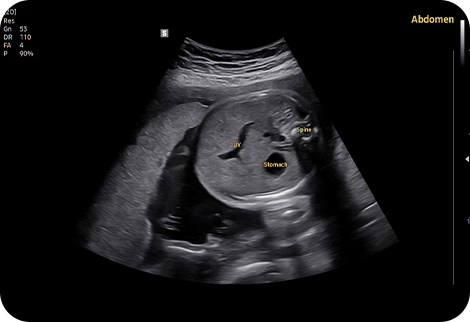 ob ultrasound tech : ViewAssist™