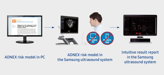 ADNEX risk model in PC/ADNEX risk model in the Samsung ultrasound system/Intuitive result report in the Samsung ultrasound system