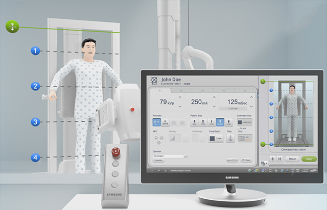 Patient erhält Röntgenaufnahme vor digitalem Röntgensystem GC85A von Samsung und Betrachtungsmonitor zeigt das die Röntgenaufnahme.