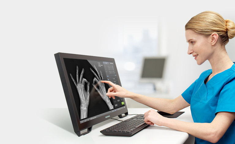 MTRA / MTA zeigt auf qualitativ hochwertige Röntgenaufnahme in Betrachtungsmonitor von Samsung.