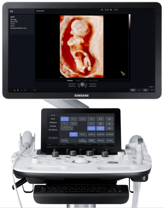 Ultraschallsystem HS40 von Samsung Frontansicht mit 3D Bild von Fetus