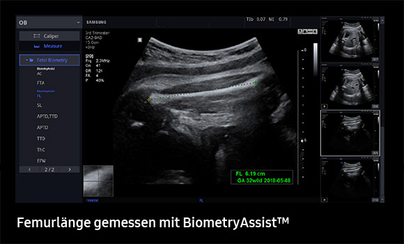Biometry Assist™