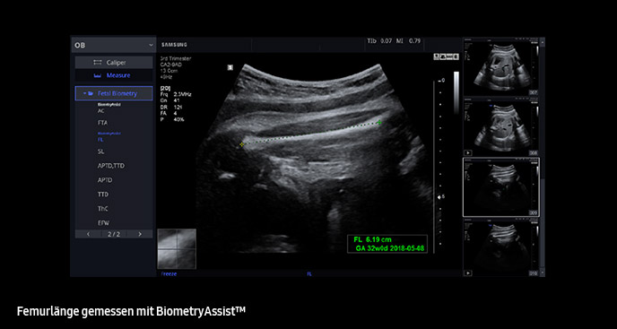 Biometry Assist™
