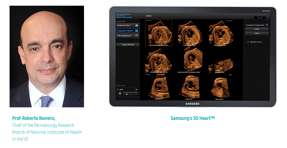 Prof. Roberto Romero, Chief of the Perinatology Research Branch of National Institutes of Health in the US / Samsung’s 5D Heart™