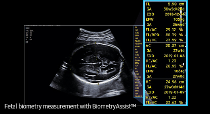 medical diagnostics of obgyn ultrasound : BiometryAssist™
